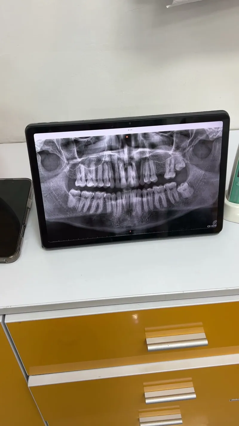 Radiografía panorámica en la pantalla del consultorio